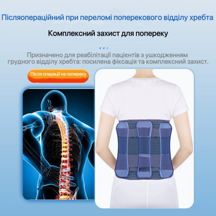 Корсет для спини після перелому - Зображення 1